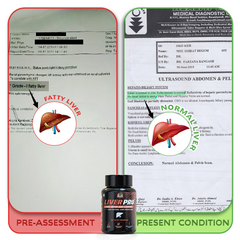 YogaManLab® Liver Pro - Fatty Liver Ayurvedic Supplement | Helps Restore Liver Health & Remove Toxins | 100% Natural & Ayurvedic | 28 Days Program