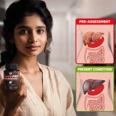 YogaManLab® Liver Pro - Fatty Liver Ayurvedic Supplement | Helps Restore Liver Health & Remove Toxins | 100% Natural & Ayurvedic | 28 Days Program