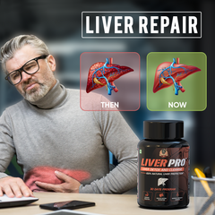 YogaManLab® Liver Pro - Fatty Liver Ayurvedic Supplement | Helps Restore Liver Health & Remove Toxins | 100% Natural & Ayurvedic | 28 Days Program