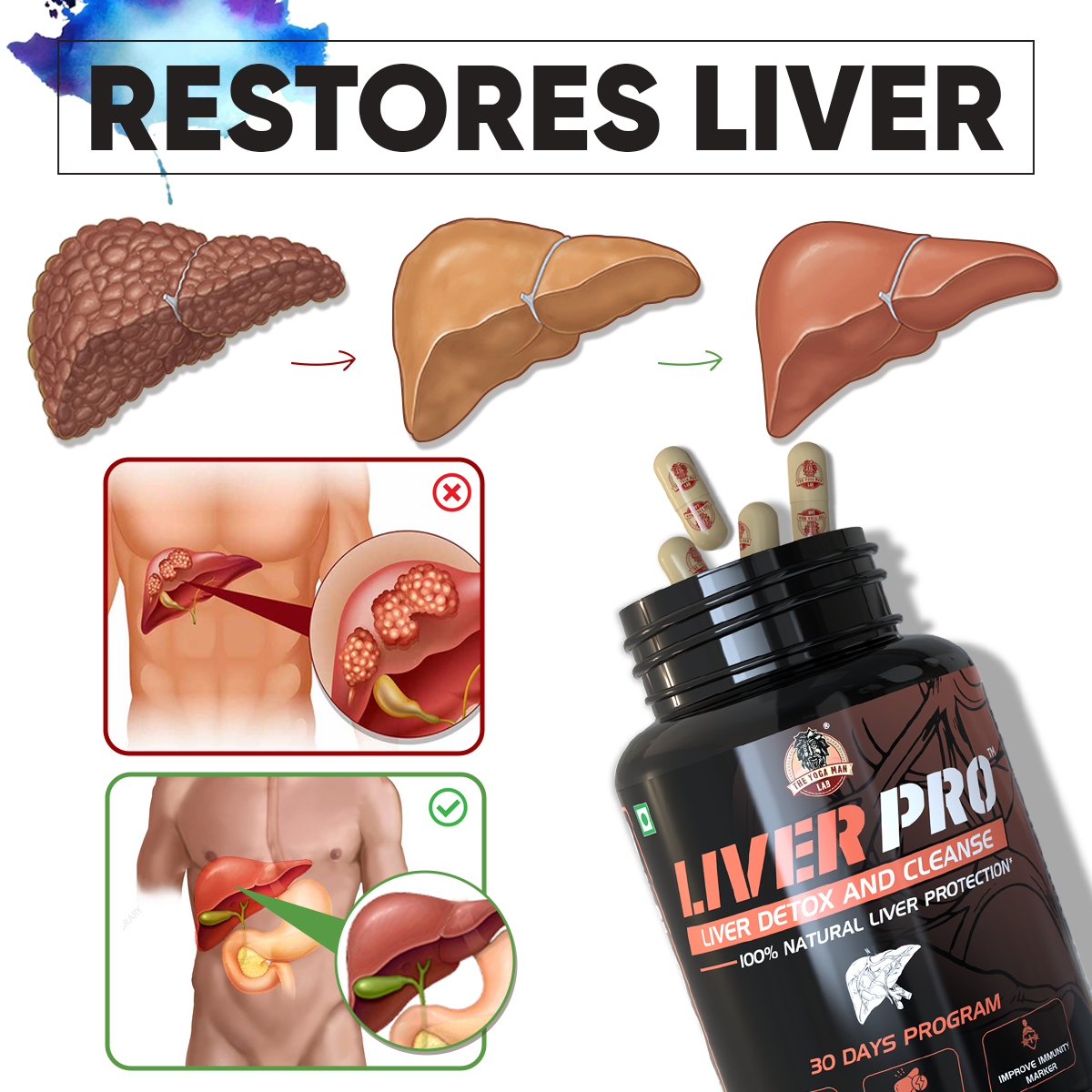 YogaManLab® Liver Pro - Fatty Liver Ayurvedic Supplement | Helps Restore Liver Health & Remove Toxins | 100% Natural & Ayurvedic | 28 Days Program