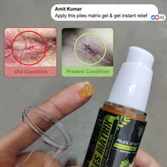 YogaManLab® PILES MATRIX - Piles Treatment Ayurvedic Capsules & Lepam Ointment | With Free Diet & Doctor | Treats Internal Grade1-4 & External Hemorrhoids | 100% Natural