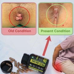 YogaManLab® PILES MATRIX - Ayurvedic Medicines for Piles Home Treatment | With Capsules, Lepam & Diet Booklet | Relives Pain & Itching, Shrinks Mass, & Treats Constipation | 100% Natural