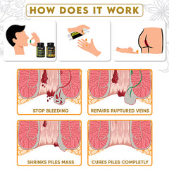 YogaManLab® PILES MATRIX - Ayurvedic Medicines for Piles Home Treatment | With Capsules, Lepam & Diet Booklet | Relives Pain & Itching, Shrinks Mass, & Treats Constipation | 100% Natural