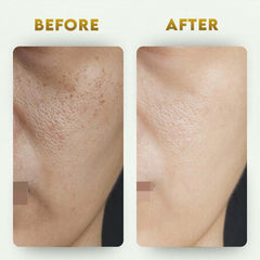 YogaManLab® Glutathione Skin Whitening Kojic Acid Soap | Makes Skin Bright & Glowing