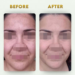 YogaManLab® Glutathione Skin Whitening Kojic Acid Soap | Makes Skin Bright & Glowing