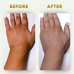 YogaManLab® Glutathione Skin Whitening Kojic Acid Soap | Makes Skin Bright & Glowing