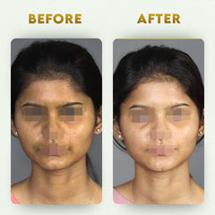 YogaManLab® Glutathione Skin Whitening Kojic Acid Soap | Makes Skin Bright & Glowing