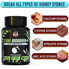 YogaManLab® STONE DISSOLVER+ - Stone Remover Ayurvedic Supplement | 100% Natural & Plant Based