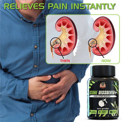 YogaManLab® STONE DISSOLVER+ - Stone Remover Ayurvedic Supplement | 100% Natural & Plant Based