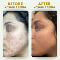 YogaManLab® 10% Vitamin-C & Ferulic Acid Face Serum | Non-Irritating & Non-Sticky | Tested for Oily, Sensitive Skin | Beginner-Friendly| Brightens Dull Skin, Evens Tone | No Purging | With 0.5% Ferulic Acid