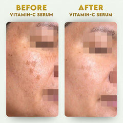 YogaManLab® 10% Vitamin-C & Ferulic Acid Face Serum | Non-Irritating & Non-Sticky | Tested for Oily, Sensitive Skin | Beginner-Friendly| Brightens Dull Skin, Evens Tone | No Purging | With 0.5% Ferulic Acid