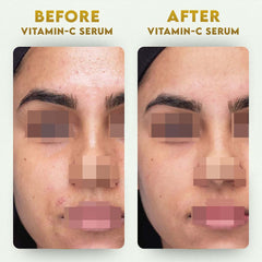 YogaManLab® 10% Vitamin-C & Ferulic Acid Face Serum | Non-Irritating & Non-Sticky | Tested for Oily, Sensitive Skin | Beginner-Friendly| Brightens Dull Skin, Evens Tone | No Purging | With 0.5% Ferulic Acid