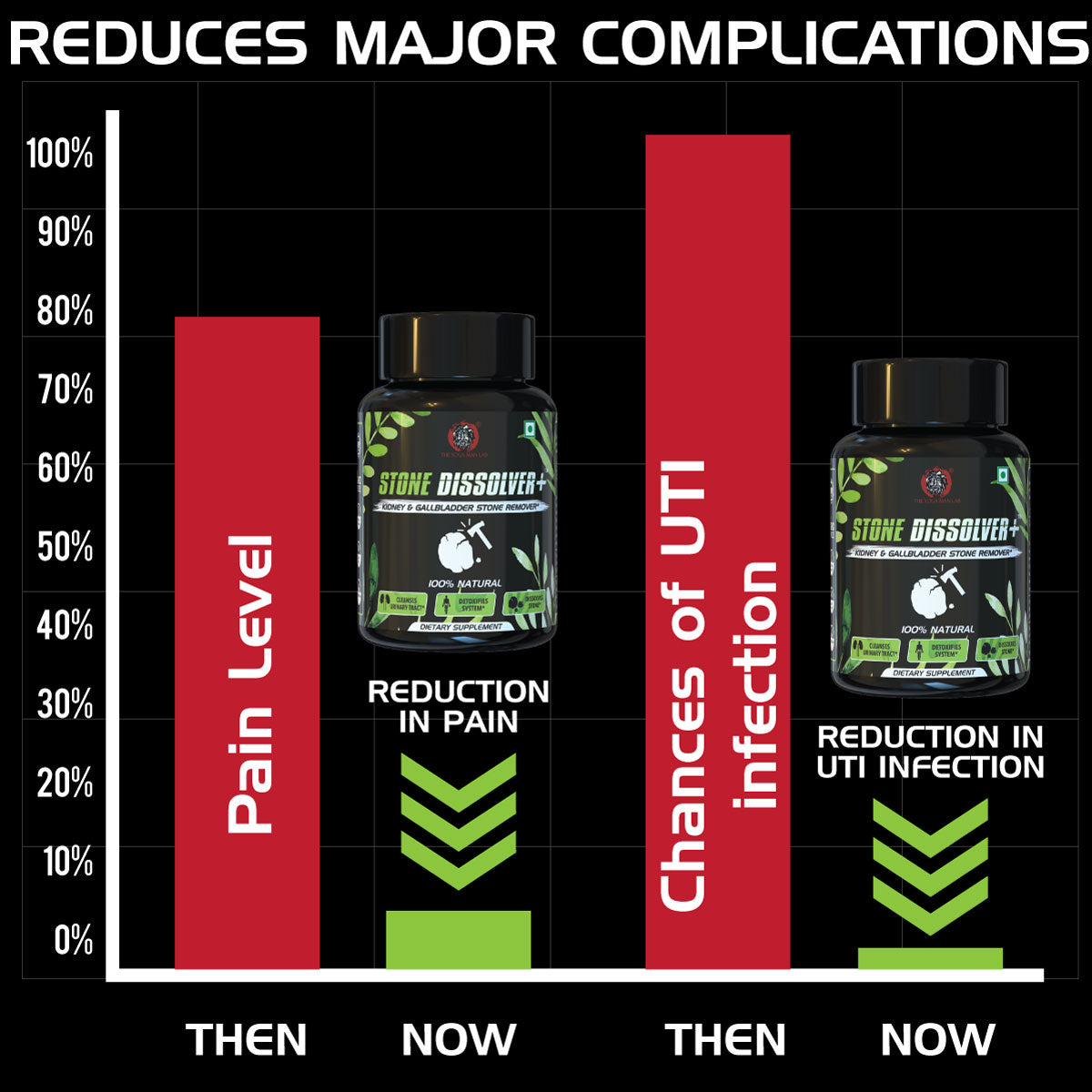 STONE DISSOLVER+ - Stone Remover Ayurvedic Supplement | 100% Natural & Plant Based Health Care > Urinary Tract Health > Kidney & Gallbladder Stone > Supplement > Ayurvedic Stone Remover Treatment The Yoga Man Lab   