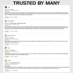 STONE DISSOLVER+ - Stone Remover Ayurvedic Supplement | 100% Natural & Plant Based Health Care > Urinary Tract Health > Kidney & Gallbladder Stone > Supplement > Ayurvedic Stone Remover Treatment The Yoga Man Lab   